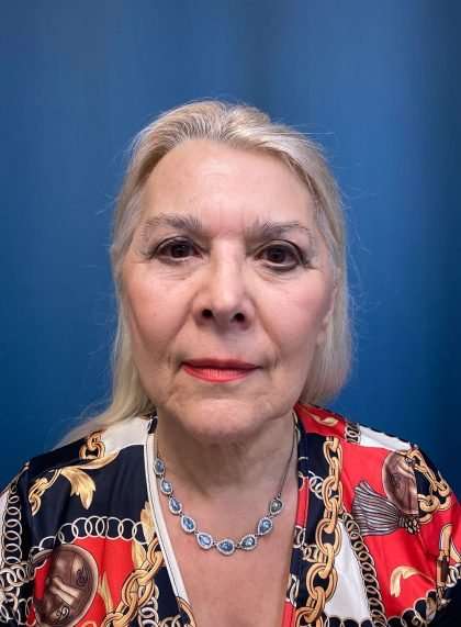 Facelift And Necklift Before & After Patient #1542