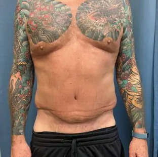 Before and After
